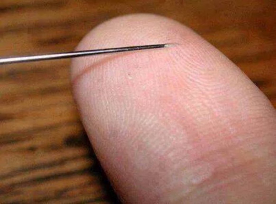 Today in 1979, your mom attempts to remove a splinter from your finger with a sewing needle. She said it wouldn’t hurt. She lied.