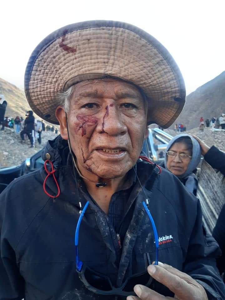 juampyBaiDal's tweet photo. La Paz social de Gerardo Morales reprimiendo con balas de goma a la cara para defender su Reforma que según el amplia derechos!!
#JujuyResiste 
#JujuyDePie 
#jujuy https://t.co/MFzgF9H2ix