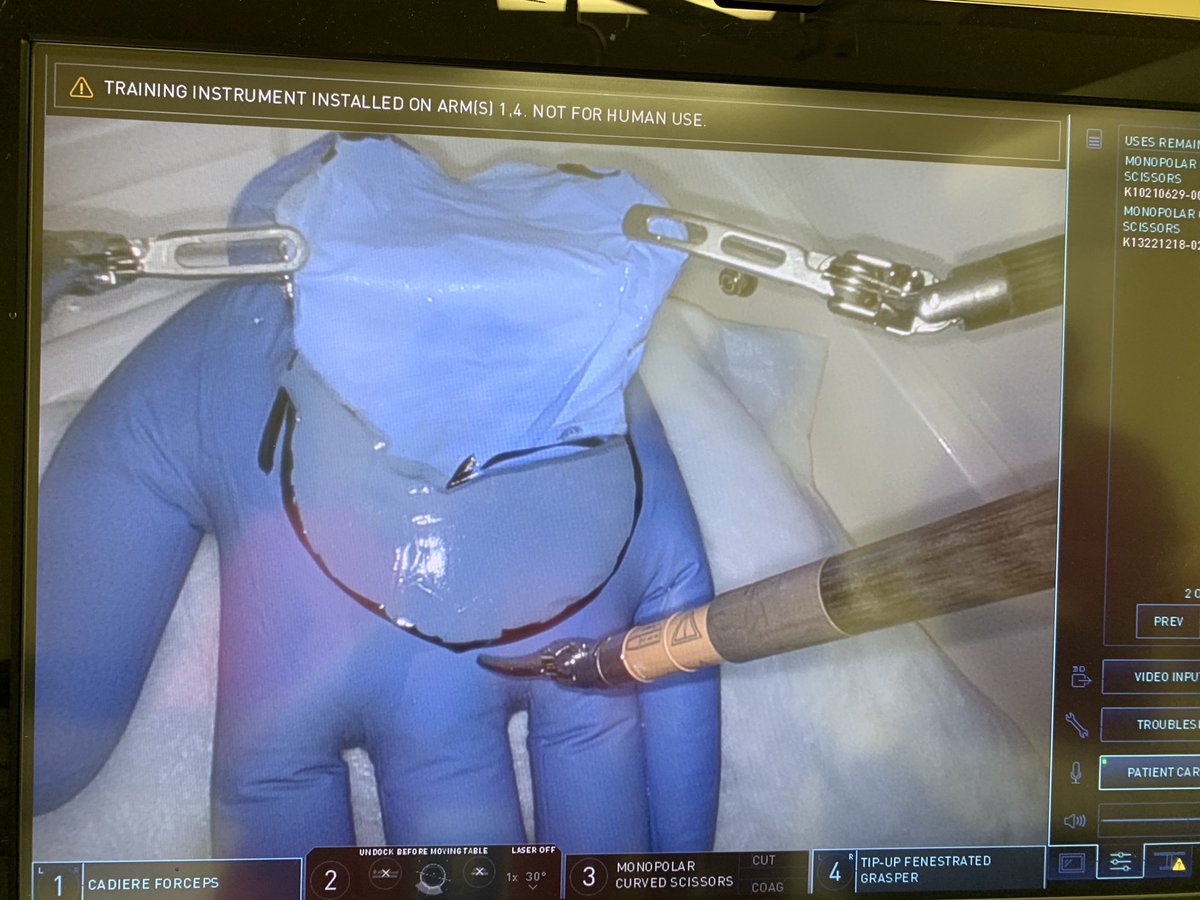 NuhaZsurgeon's tweet photo. @andrew_yiu @JimkhanMD @najafsiddiqi @PiozziMD @IMykoniatis @SamVIMARS Thanks @andrew_yiu 🥰Keep up the good work.. Your handiwork below 😉Great faculty, Awesome candidates and fun theatre team.. Thanks also to Emma, Pat, Anna, Andrew, Rauand, the Italian stallions and the whole team for making the #RoboticBasicSkills course a fab one 🤖@PColorectal https://t.co/yIPpXNqkrJ
