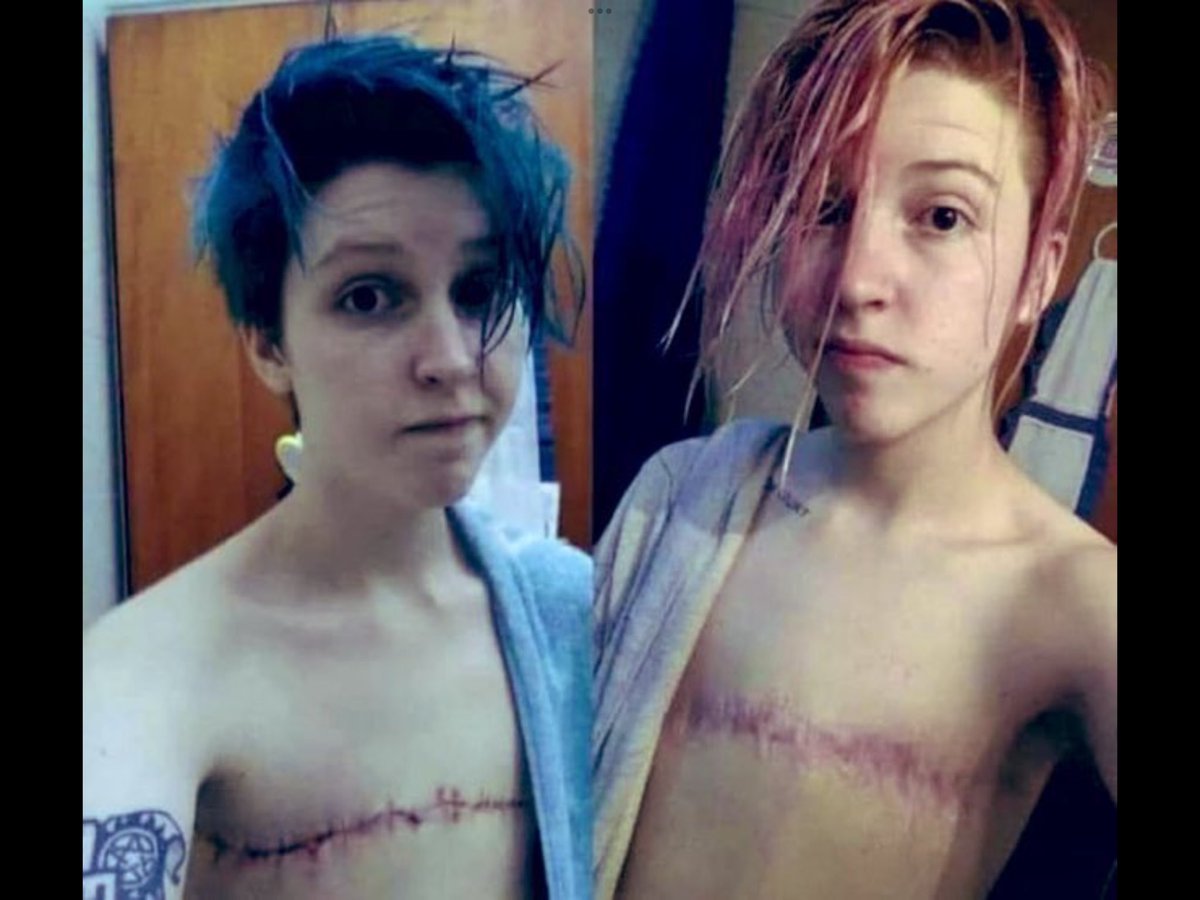 #transkids #LeaveOurKidsAlone This is “gender affirming care.” 👿 #children
