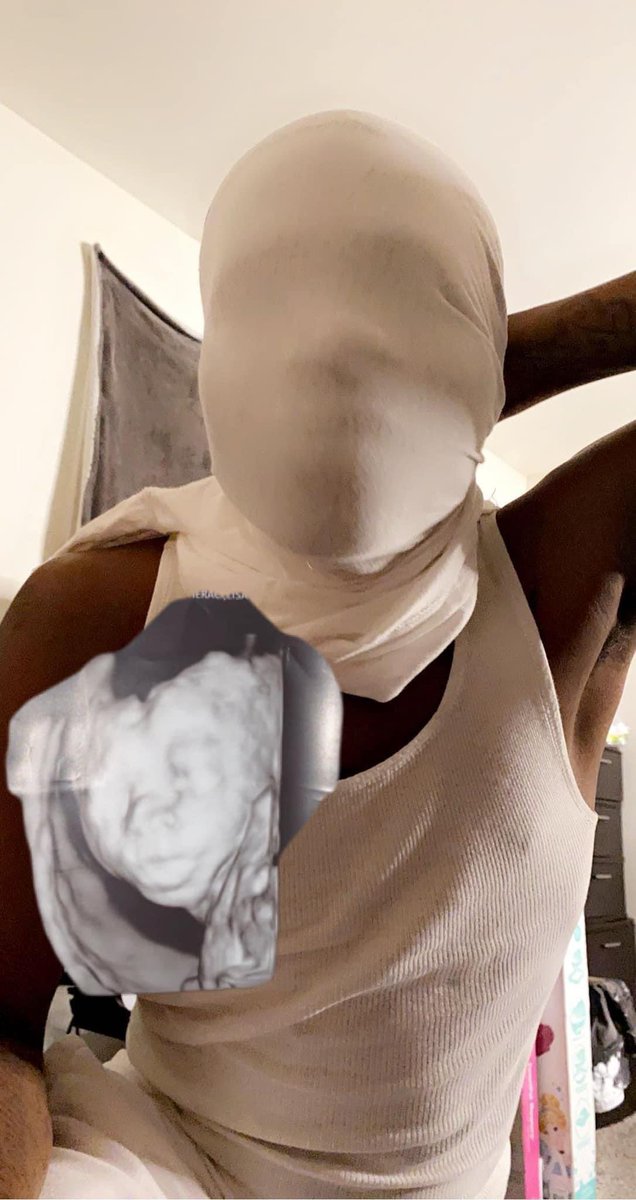 NiniDaGheee's tweet image. When you wanna find out if the baby look like you ina ultrasounds gone getchu a white shirt 😂😂😂😂😂😂😂😂😂😂😂😂😂