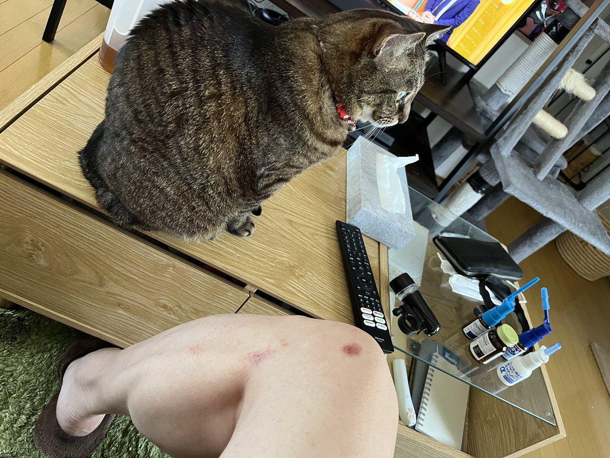 昨晩キャットフードを切らしていた事に気付きチャリに乗って急で買いに行った帰りに段差に気付かず派手にこけて膝を擦りむいて帰宅した来月50歳になるバツ3独身のおっさんです