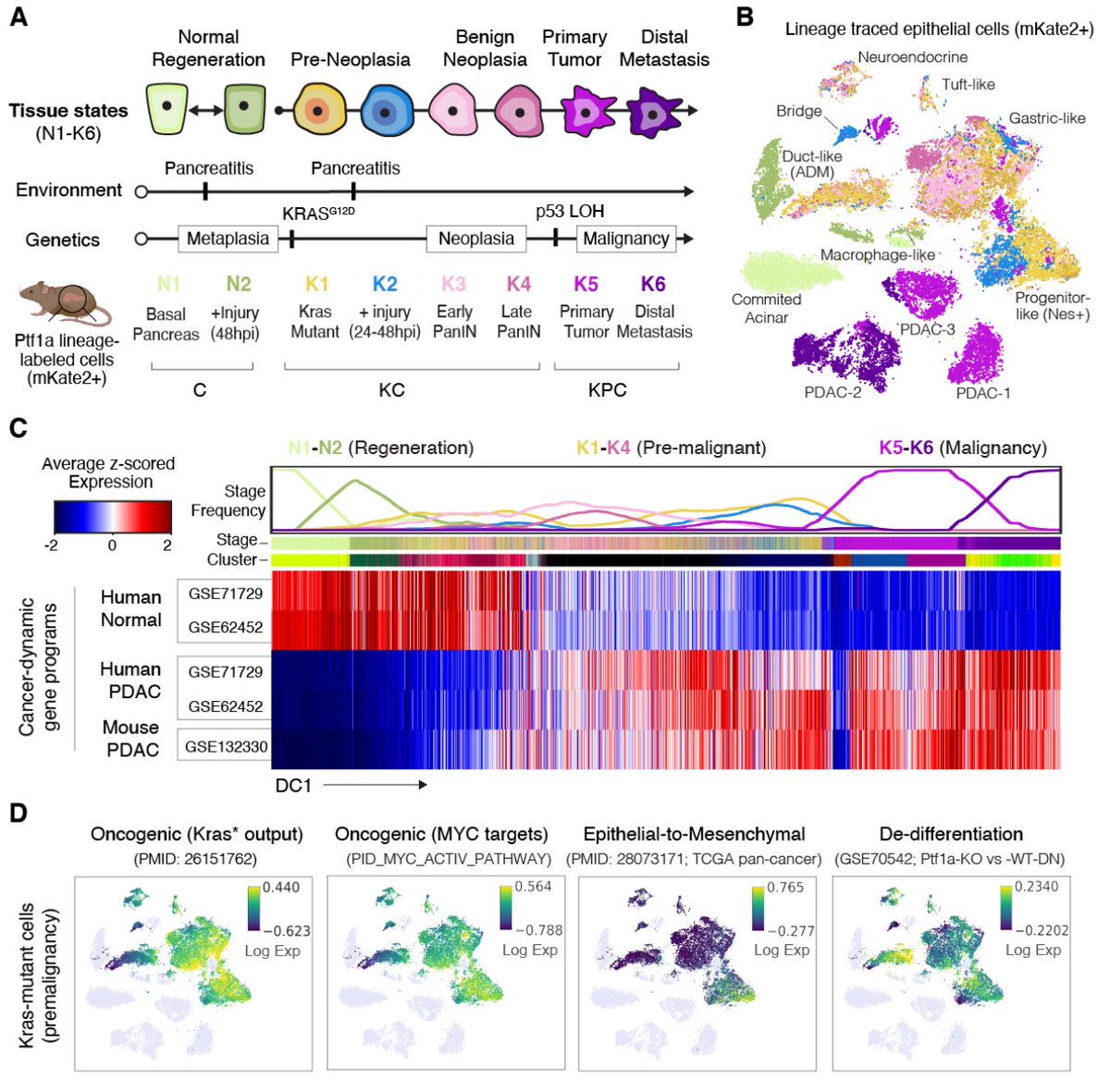 How does neoplastic happen in the pancreas
1. #Pancreatitis
2. Pancreatic Cancer #PDAC
3. Epigenetic plasticity cooperates with cell-cell interactions to direct pancreatic tumorigenesis via
@dana_peer @ScienceMagazine
science.org/doi/10.1126/sc…
#MedTwitter #MedEd #Cancer #Oncology