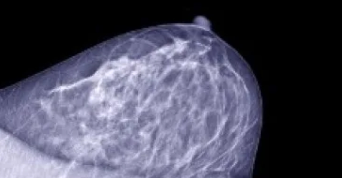 #ASCO: Neue Daten zu Ribociclib beim Mammakarzinom vorgestellt #cancer #OncTwitter
ms.spr.ly/6019gWRfP
