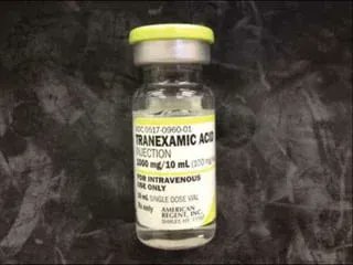 Prehospital Tranexamic Acid for Severe Trauma... buff.ly/3CxVpO6
