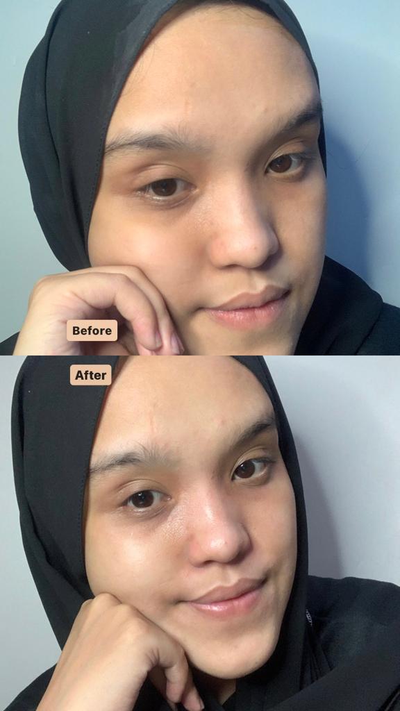 bbyagn's tweet photo. Siapa nih yang suka maskeran pakai masker organik ? 🙋‍♀️

Aku mau rekomendasi masker dari @ElmolaSkin ! Dengan harga 12 ribuan aja udah bisa maskeran dan ada banyak varian yang bisa disesuaikan dengan kondisi kulit kita &amp; udah BPOM juga ya

- a thread
#racuninskincare #racunbyagn https://t.co/c3IQ3zOGUN