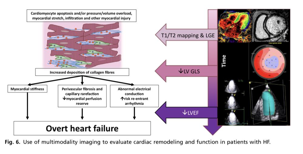 🟠 Latest Updates in Heart Failure Imaging #CardioEd #Cardiology #CardioTwitter