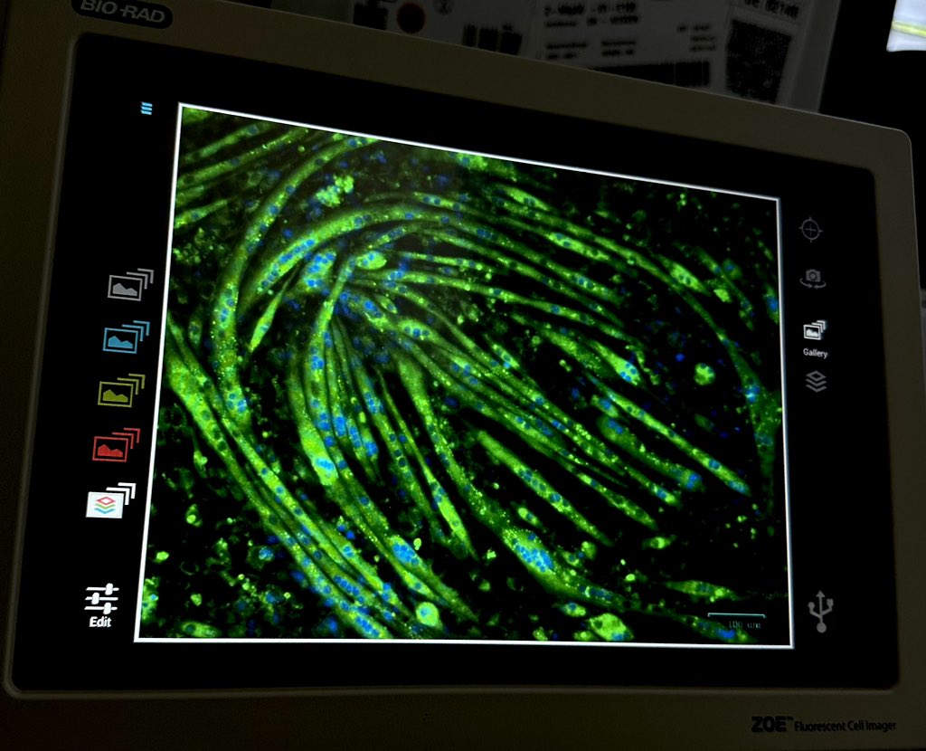 I promised myself that I would not work over the weekends. But, this is the reason why I came here 👇🏻♥️. Beautiful no?  #myotubes #myotwitter #science