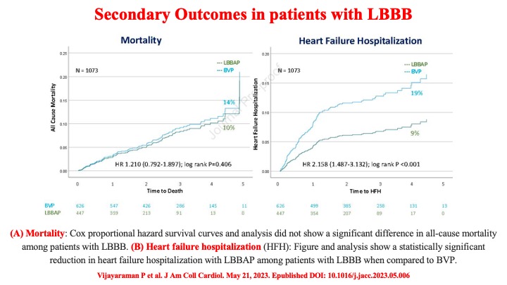 📌 In candidates for CRT
👉 LBB area pacing better than BV pacing
#HeartFailure #LBBP #CRT #JACC @Hisdoc1 @DrRoderickTung @leftbundle @narrowQRS @KennethEllenbo1 @drjohnm @JagSinghMD @GiuseppeGalati_ @ValleAlfonso @SeguraCardio @EJSMD @DrMarthaGulati @QuentinYoumans @docbhardwaj