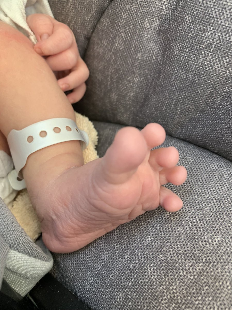 予定日に出てきた息子くん。第1子時より大変で壮絶な出産。何時間も痛みに悶え泣き叫びエピドラルも最終的には効かず10cm子宮口開いてるのに全然出てこないので緊急帝王切開に。その後も手術の反応で高熱と話せないくらいガクガク震え、もう2度と妊娠出産はしないと誓いました。でも赤子はかわいい🥹🫶