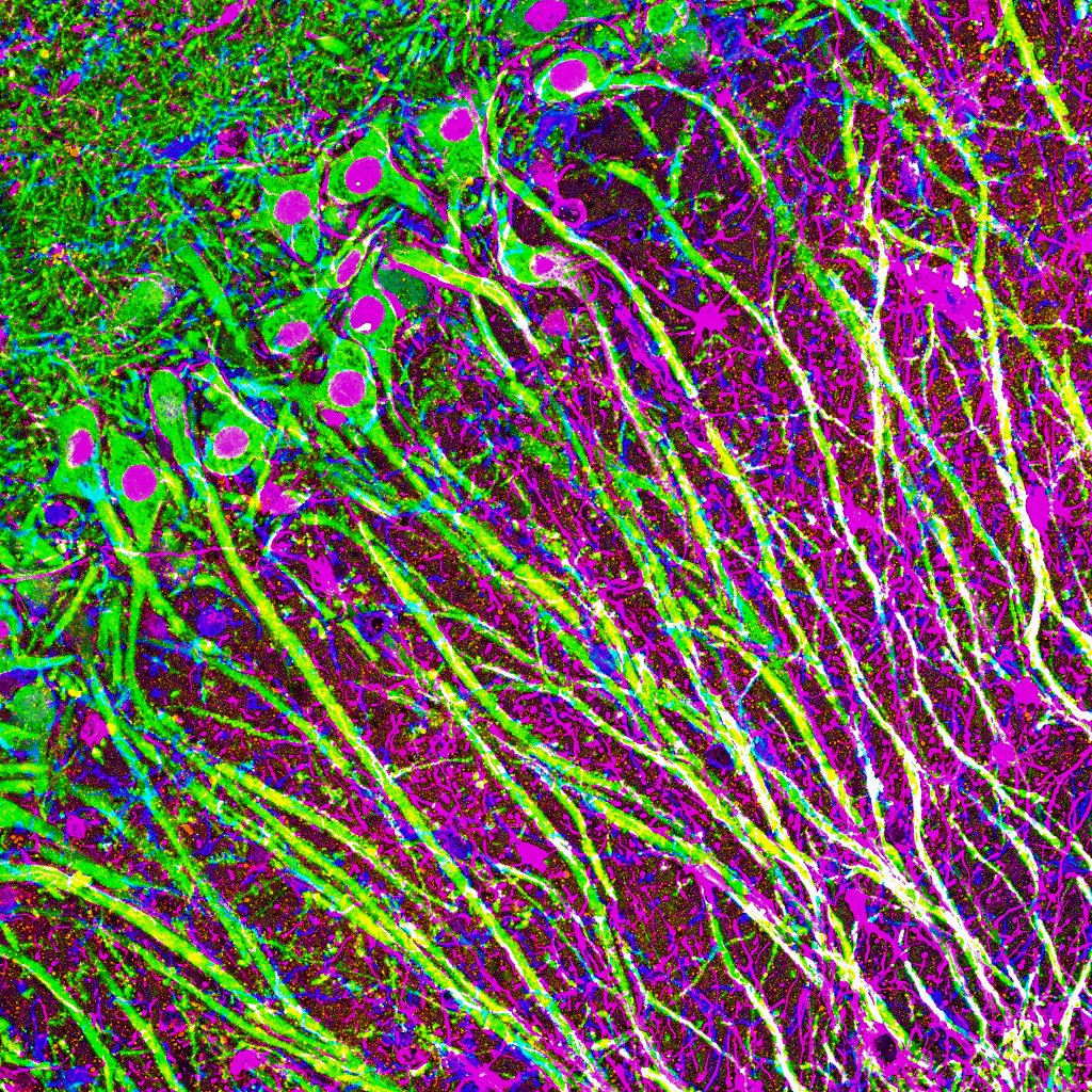 Hippocampal CA1 Neurons are pretty! Staining: neuron (MAP2-green), astrocyte (GFAP-purple), microglia (iba1-blue) #microscopy #neuroscience