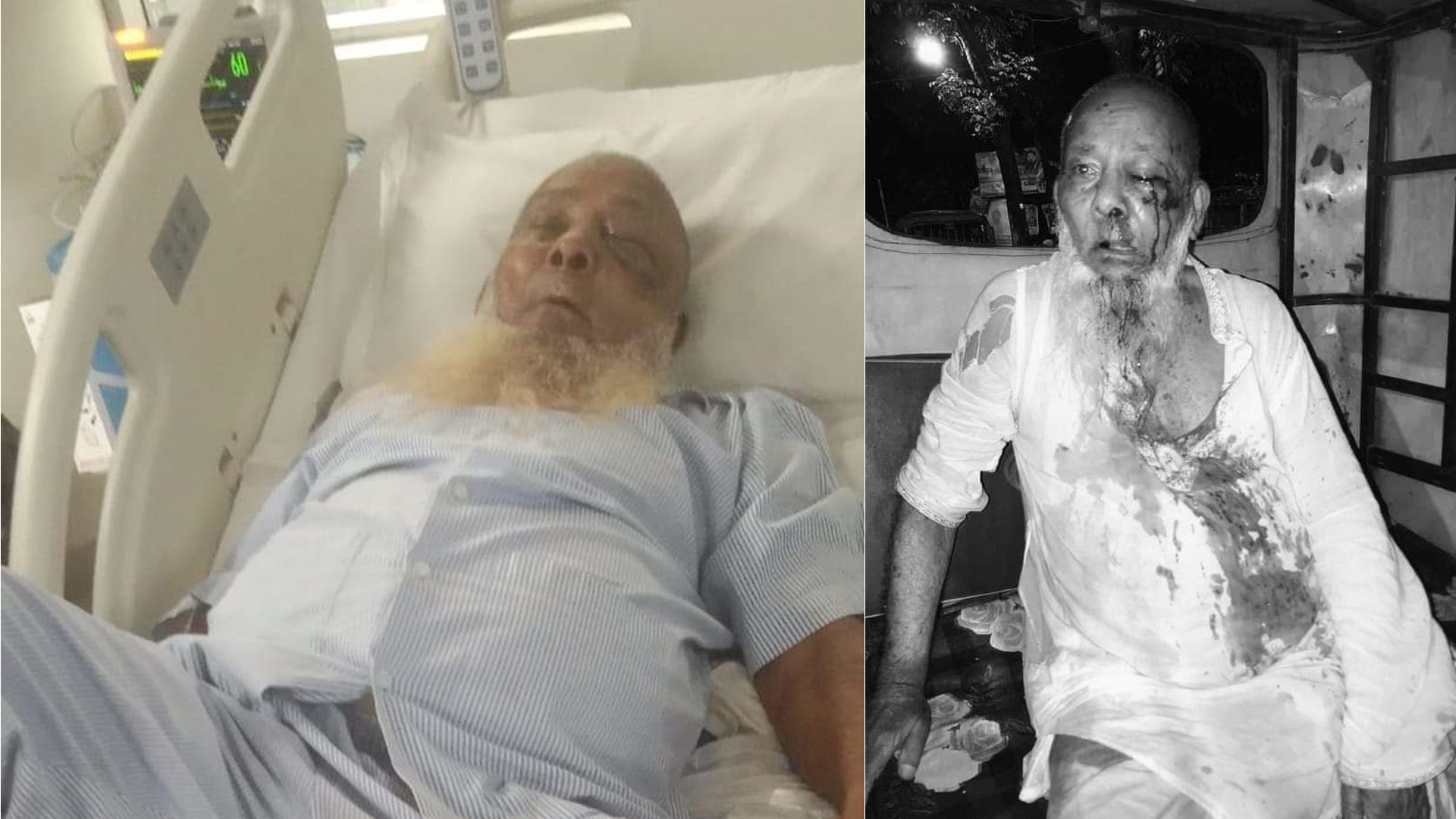 অবশেষে মারা গেলেন ছেলের হাতে আহত সেই পিতা