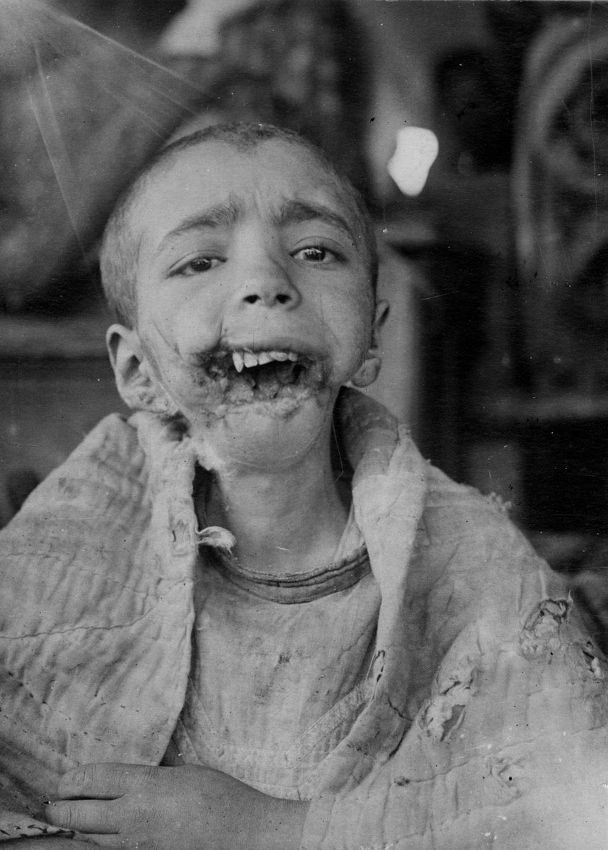 During the Turkish War of Independence, Turkish civilians experienced horrifying attacks from occupying forces. One of the victims was a 13-year-old Turkish girl, Hayriye. Greek soldiers raped her and detonated a grenade in her mouth.  (Yalova Massacre, 1921)