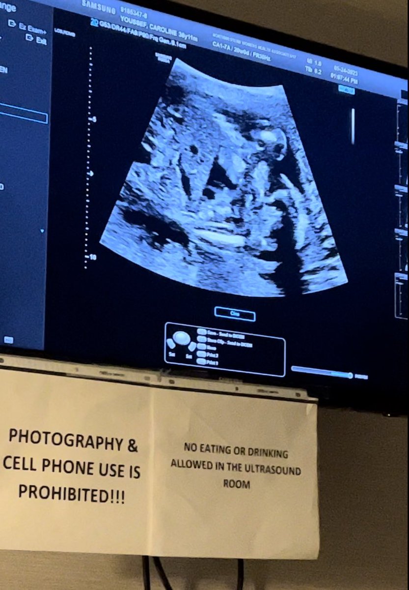 glabuz "Steady Greg"🔺 tweet media