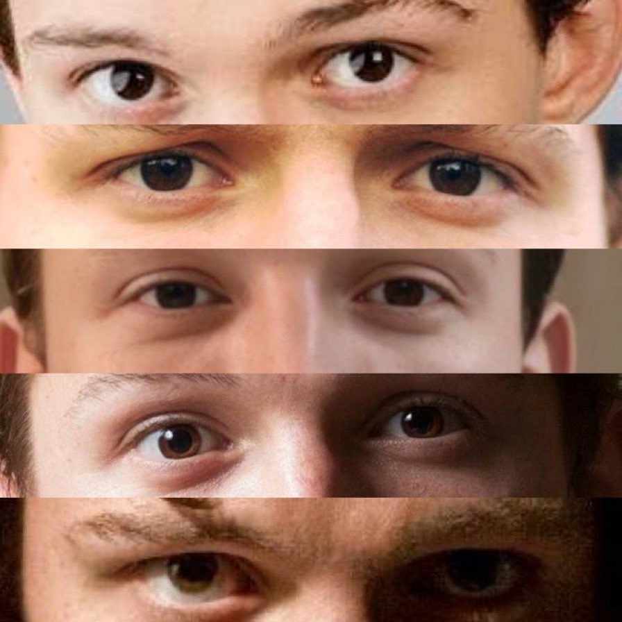 category: eyes