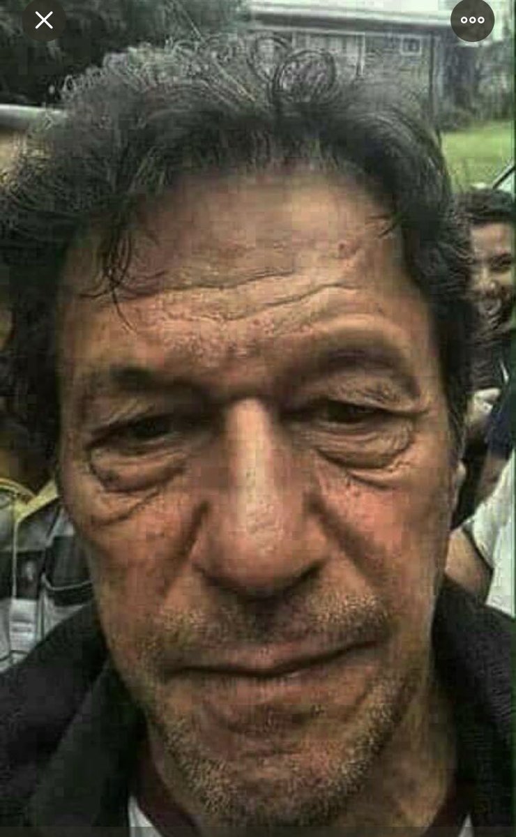 @MALHACHIMI Real face of Imran Khan without photoshop