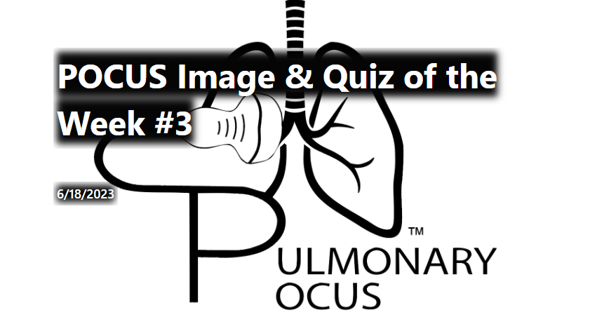Join the IUSM PCCM Fellows and take the POCUS Quiz of the week. Click the link below!

forms.office.com/r/EkY08wX5d3