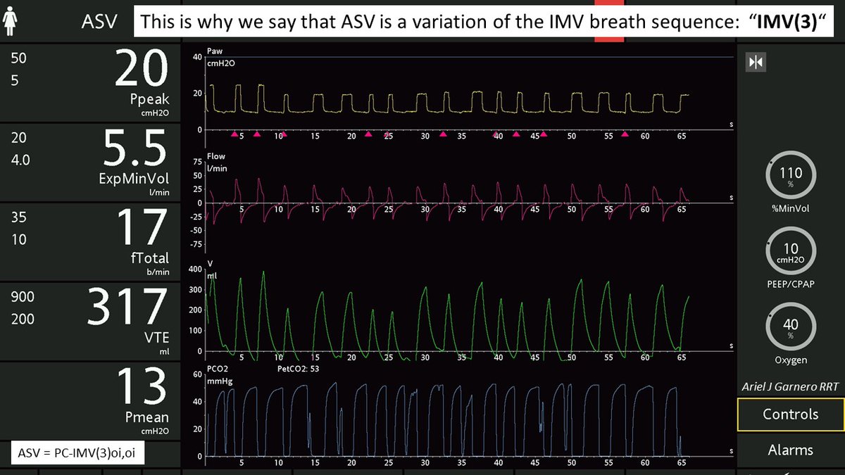 Taxonomy of the Modes: IMV(3): Mandatory breaths are reintroduced when the observed Minute Ventilation < Set Minute Ventilation. @ventilacionmeca @DrMiguelIbarra1 @DocMusician @emireles_c @CCF_PCCM @RyanCutro @OfVentilation @_MSAMEED @msiuba
