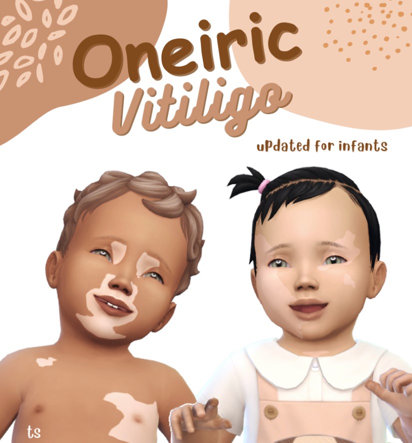—  Oneiric Vitiligo by MELICHRYSES🫶🏻  by tinysimmer

Featured here! ⬇️
🔗snootysims.com/customcontent/…

#snootysims #thesims4 #sims4 #ts4 #sims4cc #ts4cc #sims4ccfinds #ts4ccfinds #sims4downloads #ts4downloads