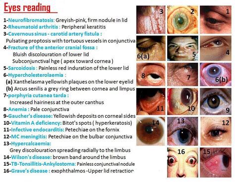 Eyes in medicine #MedTwitter