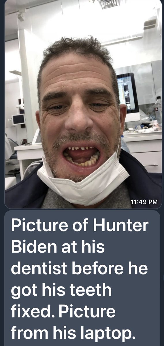 Meth amphetamine teeth Hunter Biden .