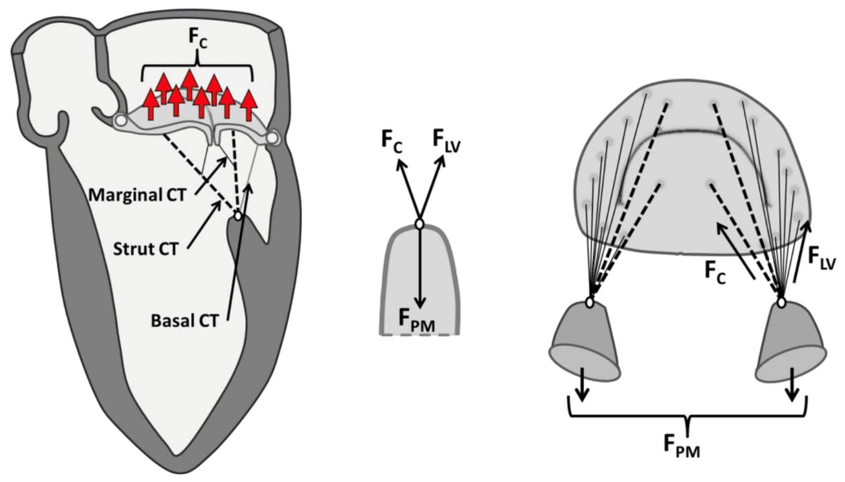 Bioeng_MDPI's tweet image. The Editor's choice paper: "Utilization of Engineering Advances for Detailed #Biomechanical Characterization of the Mitral–#Ventricular Relationship to Optimize Repair Strategies: A Comprehensive Review" by Antonia van Kampen et al. Free Reading: mdpi.com/2306-5354/10/5…