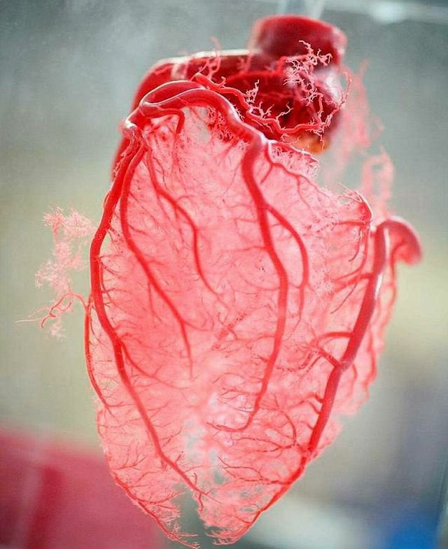 Innov_Medicine's tweet image. Resin cast of human heart blood vessels
@Innov_Medicine @imedverse 
#internalmedicine #TipsForNewDocs #MedEd #MedTwitter #medicine #medical #medicare #health #healthcare #FOAMed #ClinicalPearl #clinicaltips #MedStudents #CardioEd #Cardiology #Cardiotwitter #Cardiovascular