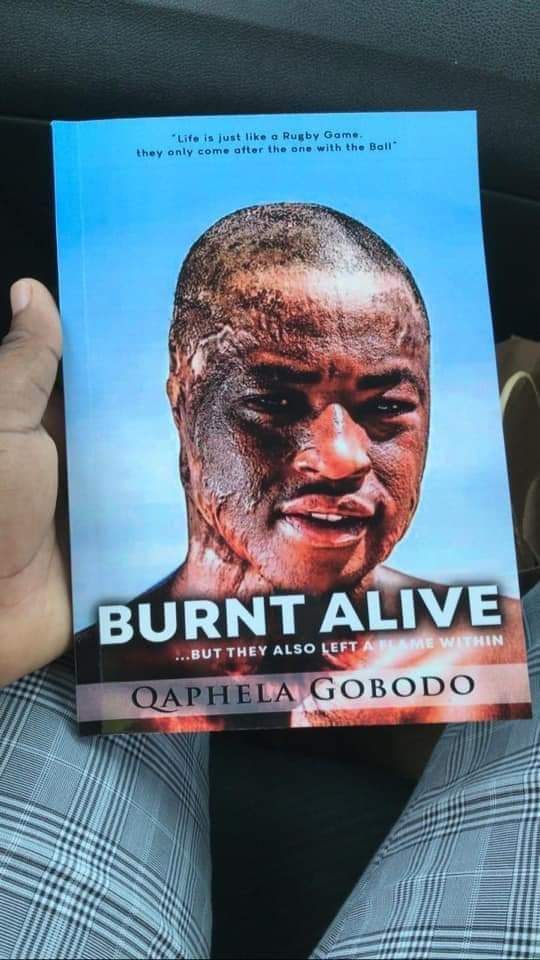 theseerheals's tweet photo. Meet Qhaphela Gobodo!

He was burnt by his classmates in 2016 after being the 1st black kid in his school to get a rugby scholarship.
He’s made a remarkable recovery &amp; still loves Rugby very much. He has over 20 surgeries.
He’s now a Motivational Speaker.
His book is out. https://t.co/4nqIoK0xID