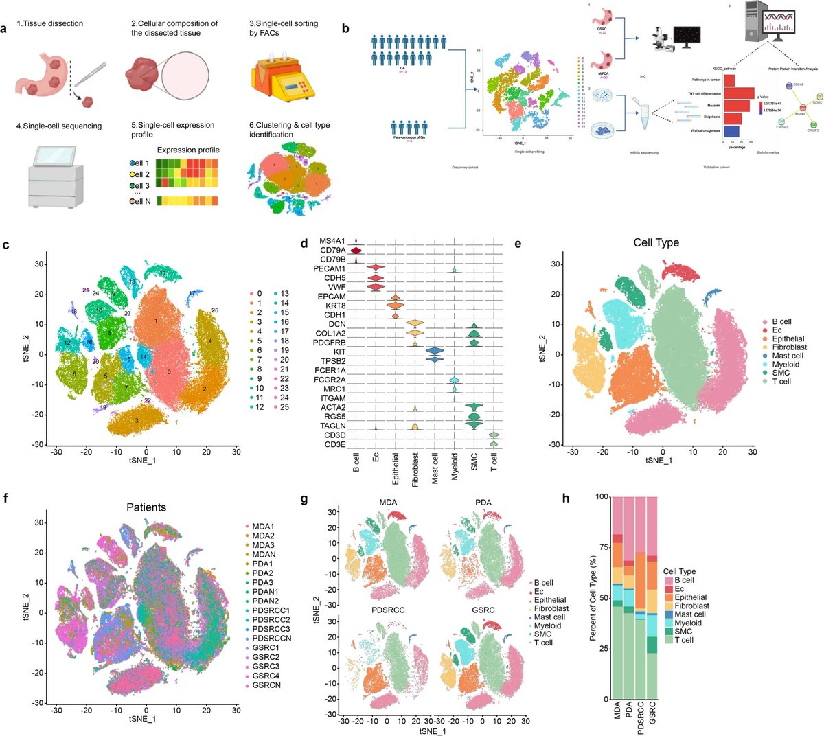Assessment of gastric signet ring cell carcinoma using #scRNAseq! go.nature.com/3MMTJVT GSRC exhibits unique cytological and immune microenvironment characteristics. For instance, signet ring cell carcinoma cells are enriched in oestrogen signalling pathways. #singlecell
