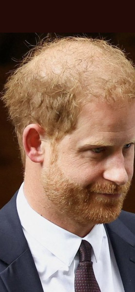 He criticised William how bloody DARE he!!! Well William at least did the decent thing and embraced his baldness and suits it! Harry’s beard has more hair than his head! Is that a WIRE I see?Maybe he needs ex help in his ans from afar! #HarryonTrial #HarryisaBackstabbingLiar