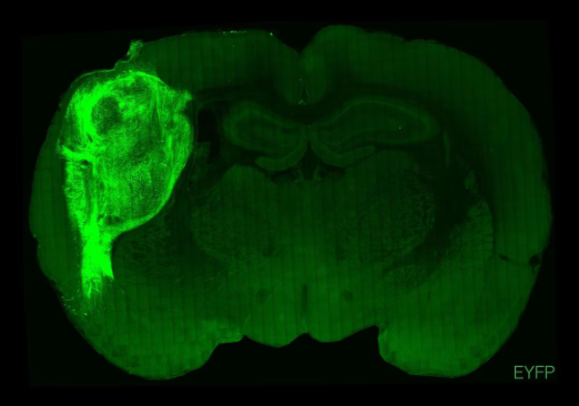 upfbioeng's tweet photo. I leave you the link of the published article “ Maturation and circuit integration of transplanted human cortical organoids” https://t.co/PVTX0CNaWu https://t.co/5dinXBtagh
