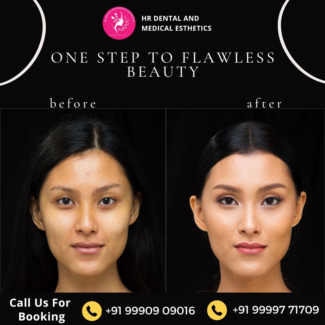 Introducing HR Dental And Medical Aesthetics, your ultimate destination for a stunning transformation. 
For bookings, call Dr. Himani Bhardwaj at +91 99997 71709 or visit our clinic at SB 34, Shashtri Nagar, Ghaziabad.
 #FlawlessBeauty #HRDentalAndMedicalAesthetics #hrdentalcare