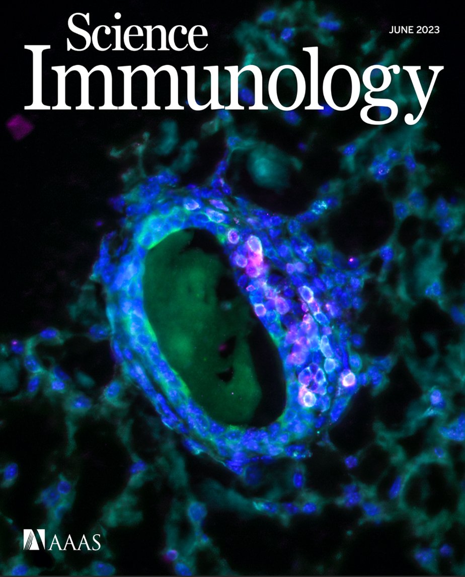 Olivia C. Ghirardelli Smith (@oliviacs_) on Twitter photo Ever wondered what T cell immunosurveillance of 🐭 mammary ducts looks like? Check out our image featured on the new cover of <a href="/SciImmunology/">Science Immunology</a>, showing CD103+ (pink) antiviral memory T cells (cyan) w/ in the ductal epithelium 🤩 <a href="/Masopust_Vezys/">Masopust Vezys Lab</a> <a href="/Noah_V_Gavil/">Noah Veis Gavil, MD, PhD</a> Ever wondered what T cell immunosurveillance of 🐭 mammary ducts looks like? Check out our image featured on the new cover of <a href="/SciImmunology/">Science Immunology</a>, showing CD103+ (pink) antiviral memory T cells (cyan) w/ in the ductal epithelium 🤩 <a href="/Masopust_Vezys/">Masopust Vezys Lab</a> <a href="/Noah_V_Gavil/">Noah Veis Gavil, MD, PhD</a>