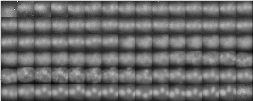 KristinaUlicna's tweet photo. Plus, how do we even [numbers-wise]🔢 represent the image information🔬 in these unequally-long tracks, when the image signal looks as noisy📢 &amp; complex as this?😱 #skimage regionprops &amp; simple intensity won't do in advanced, shape-changing #CellCycle reporters such as #PCNA 👀👇 https://t.co/ltMPbHYDkV