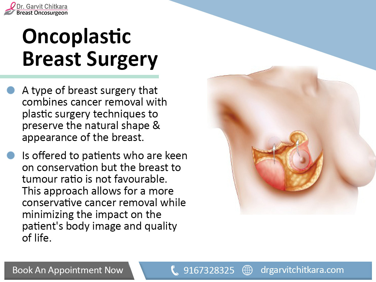 'Healing, Harmony, and Hope - Empowering Women Through Onco-Plastic Breast Surgery'

For more information visit: drgarvitchitkara.com 

#breastcancersurgeon #oncoplasticbreastsurgery #drgarvitchitkara #mumbai #breastsurgery #breastcancersupport #cancercare