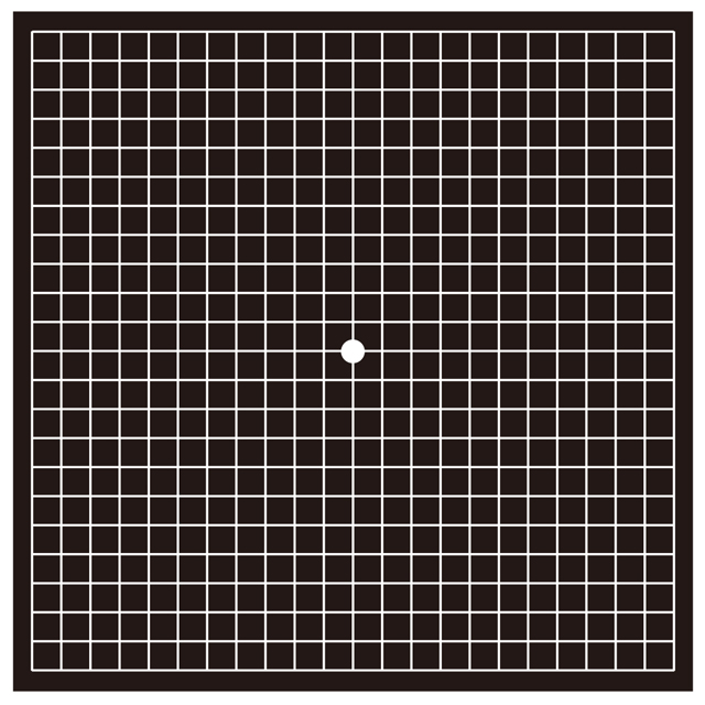 tokai200x's tweet image. 6/7は「#緑内障を考える日」だそうです。

40代以上で、ストレスを受けやすい人は気を付けて！失明につながる「緑内障」セルフチェック mainichigahakken.net/health/article… #毎日が発見
