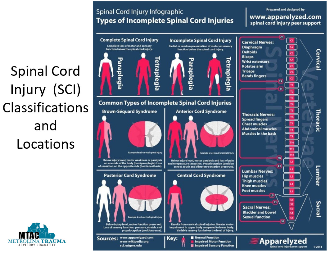 Complete? Incomplete? Anterior? Posterior? Central? Are you up to date on the various types of Spinal Cord Injuries? 

#TraumaEducation #MetrolinaTrauma #SoMe4Trauma #FOAMed #TraumaCenter #TraumaSurgery #TraumaNurse #EmergencyNurse #EmergencyMedicine #Prehospital #Paramedic