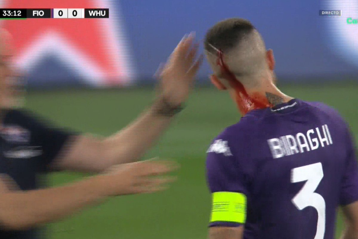 Le han lanzado varios objetos a Biraghi y parece que con el filo de un vaso de plástico le han abierto una brecha, si le da en el ojo lo desgracia.

¿Se entiende ya, <a href="/RealBetis/">Real Betis Balompié 🌴💚</a>? ¿O seguimos contando julios?