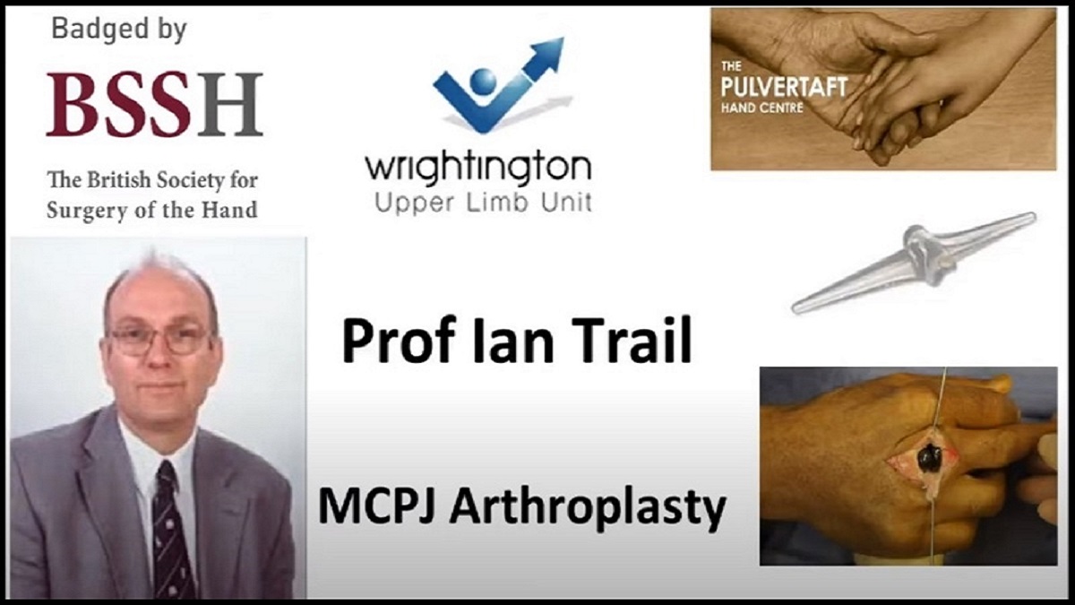ipokrate's tweet photo. MCPJ Arthroplasty by Prof Ian Trail

Watch and learn today from the Pulvertaft Videos series on "MCPJ arthroplasty, including silastic and anatomical replacement, both for osteoarthritis and for inflammatory arthritis."

https://t.co/OrmVU7xMYX

#ipokrate #conference #doctor https://t.co/kMQih1PLBC