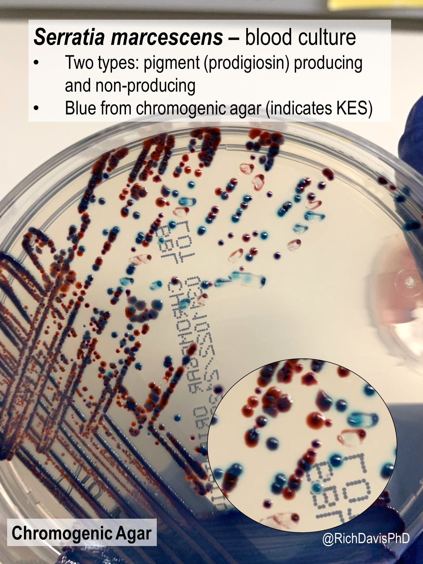 Rich Davis, PhD, D(ABMM), MLS🧫🦠 on X: Rich Davis, PhD, D(ABMM), MLS🧫🦠 on X: