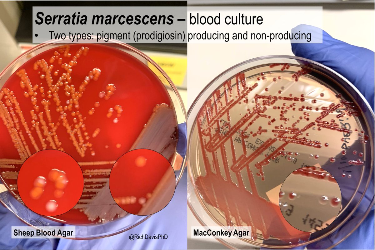 Frontiers | Transcriptional factor OmpR positively regulates prodigiosin  biosynthesis in Serratia marcescens FZSF02 by binding with the promoter of  the prodigiosin cluster, image size:1200x801
