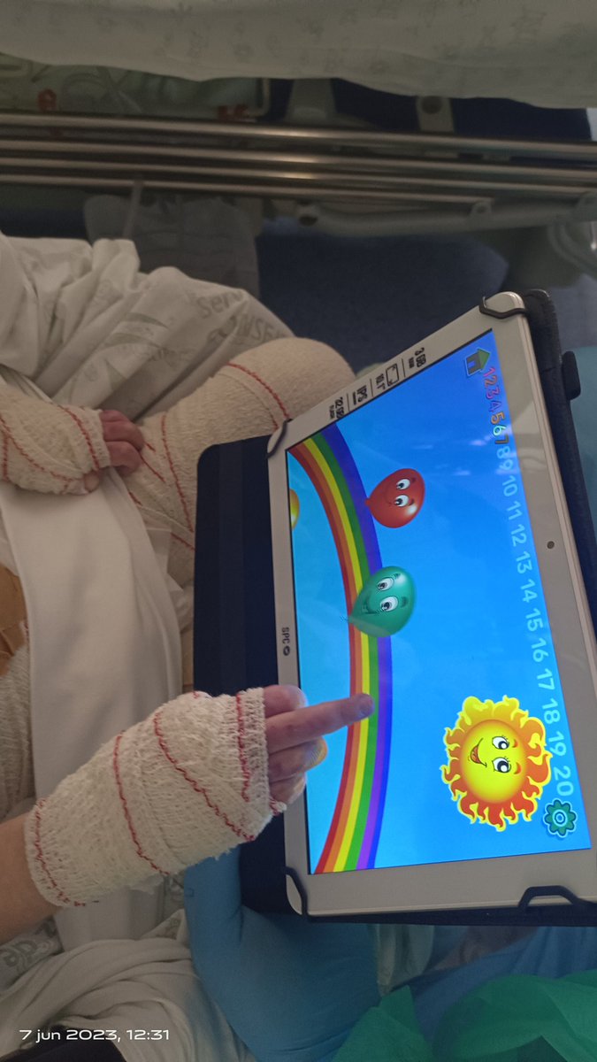 En la Escuela H.I <a href="/HospitalUVRocio/">Hospital Universitario Virgen del Rocío</a> estamos convencidos que el trabajo en equipo es la mejor metodología. Respetando tiempos y espacios. Hasta en entornos delicados como <a href="/UCIPedHUVR/">UCI Pediatría HospitalUvRocío</a> la estimulación y rehabilitación cognitiva ayudan a salir de la cama y avanzar en la recuperación💟