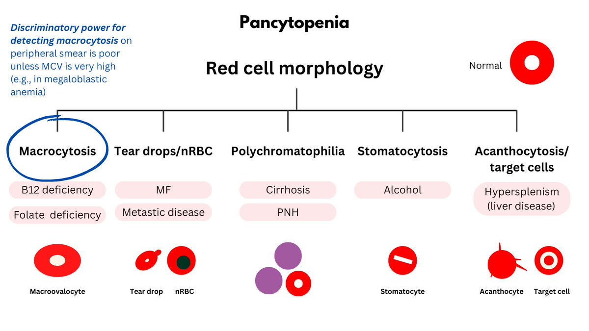 4/5

2. The other classification scheme (relevant to the matching exercise) is according to changes in the peripheral blood smear. 

2a. RBC morphology
