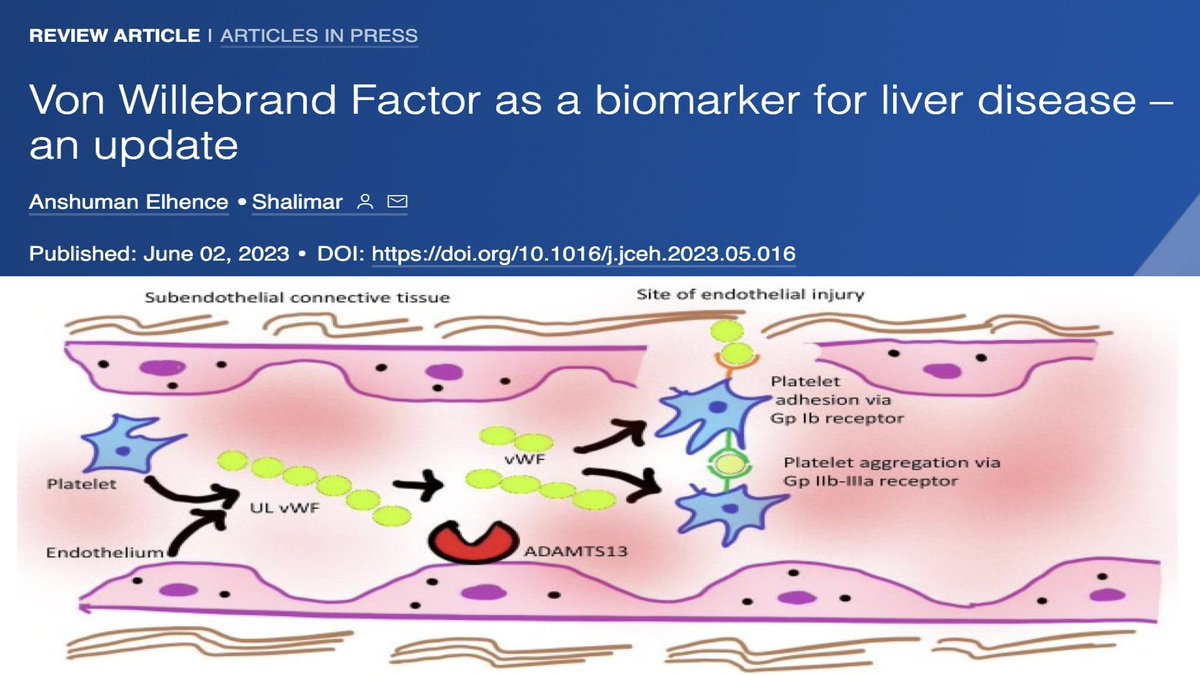 An update on use of vWF as a biomarker for liver diseases from Prof Shalimar's lab at AIIMS, New Delhi @drshalimar doi.org/10.1016/j.jceh… @Being_Medico @JCEH_Hepatology @aiims_newdelhi