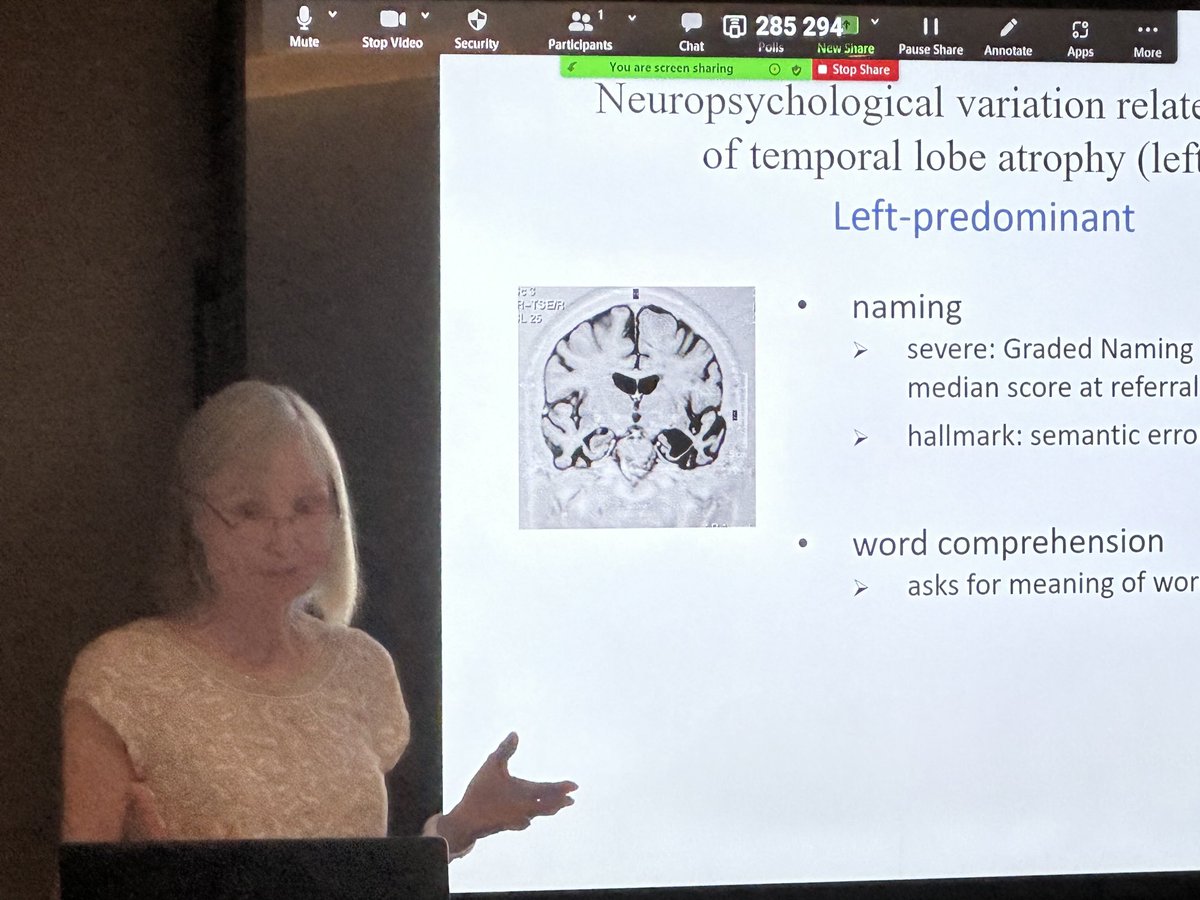 Professor Julie Snowden displays her extensive knowledge of the neuropsychology of dementia that makes her consistently one of the most  highly rated clinical teachers on the Glasgow neuropsychology programme. 20 years of progress in understanding dementia but much more to learn.