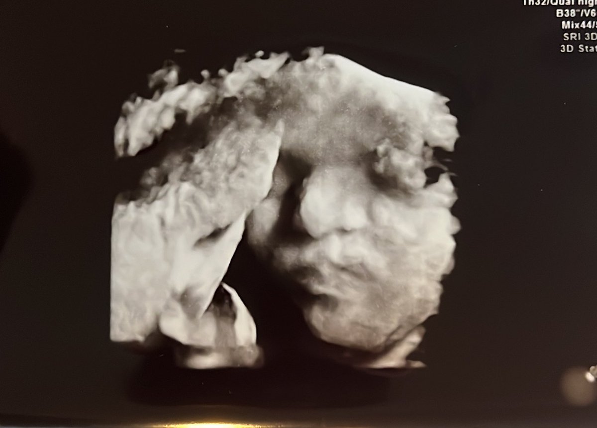 Mario Joos tweet media