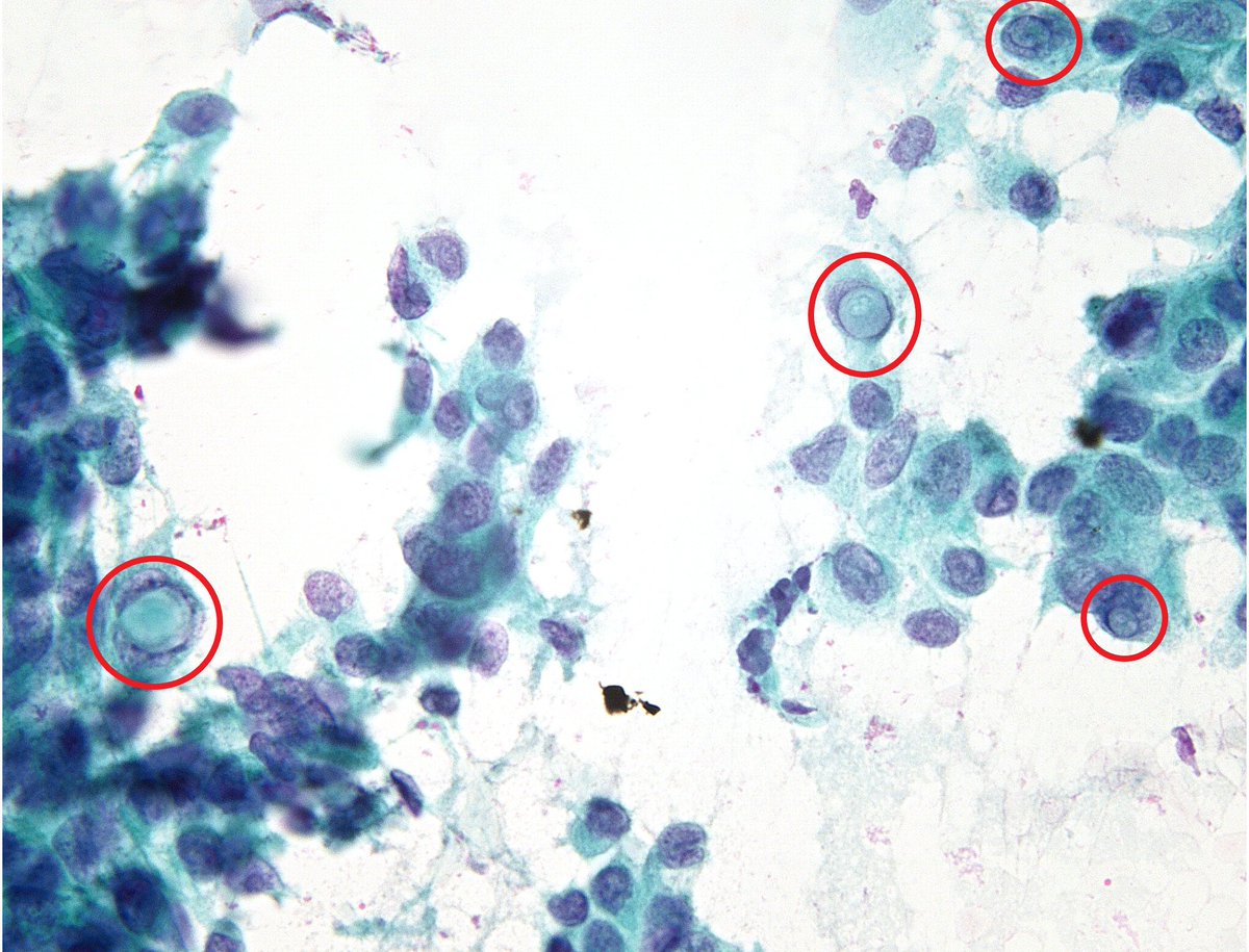 Syed Z. Ali tweet media