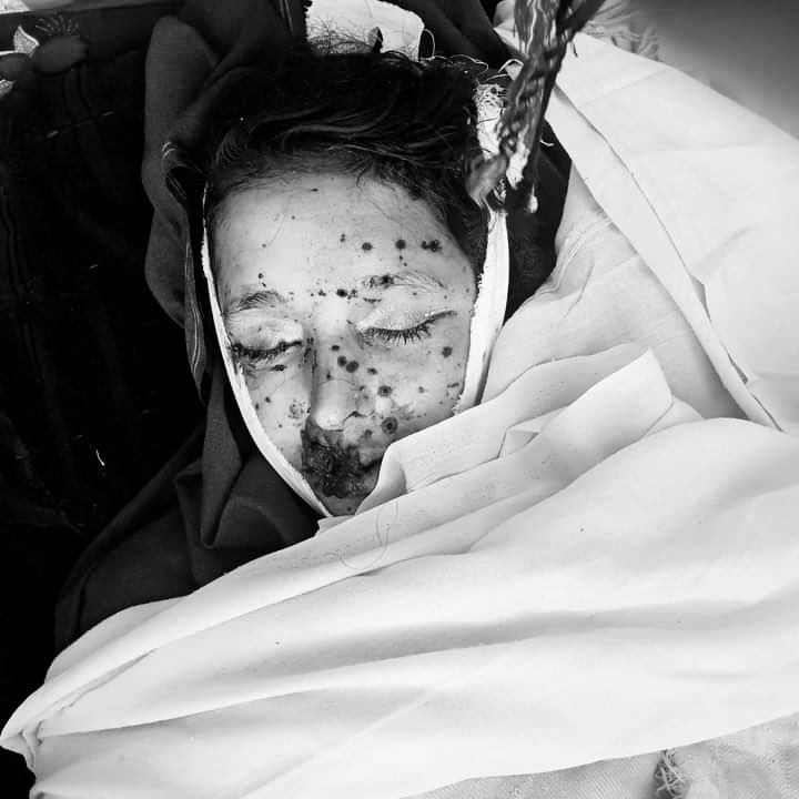 ManzoorPashteen's tweet photo. پاکستانی فورسز کے بچائے گئے لینڈ مائنز سے جنوبی وزیرستان توندہ درہ میں 2 معصوم بہنیں شہید۔
کوئی ایک دن بھی ایسا نہیں گزرتا ہے کہ ریاستی اداروں یا انکے پالیسیوں کی وجہ سے پشتونوں کا خون نہیں بہایا گیا ہو۔
900سے زائد بچے صرف جنوبی وزیرستان میں لینڈ مائنز سے معزور یا شہید ہوچکے ہیں۔ https://t.co/9esrih1uKB