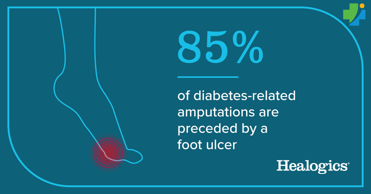 HMCHospital's tweet photo. If you or a loved one with diabetes has a non-healing wound, seek specialized care. A wound care team can prevent complications and possible amputation. #diabetes #DFU #diabeticfootulcer #WoundCareAwareness #ComeHealWithUs #chronicwounds #woundcare #Healogics https://t.co/L1JZyvTfxq