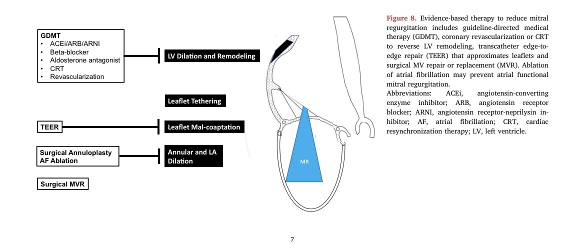 Serginho1409's tweet photo. Review Article
Secondary Mitral Regurgitation: Cardiac Remodeling, Diagnosis,
and Management
https://t.co/Y1cZfR65D8
#echfirst #mitral #Cardiology #CardioEd #cardiotuiter @Mitrovalvology https://t.co/bN4XkSfx2V